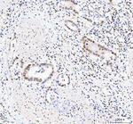 DDX1 Antibody in Immunohistochemistry (Paraffin) (IHC (P))
