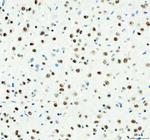 DDX1 Antibody in Immunohistochemistry (Paraffin) (IHC (P))