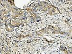 RNH1 Antibody in Immunohistochemistry (Paraffin) (IHC (P))