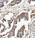 RNH1 Antibody in Immunohistochemistry (Paraffin) (IHC (P))