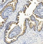 RNH1 Antibody in Immunohistochemistry (Paraffin) (IHC (P))