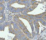 ACSL4 Antibody in Immunohistochemistry (Paraffin) (IHC (P))
