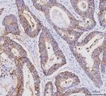 Claudin 3 Antibody in Immunohistochemistry (Paraffin) (IHC (P))