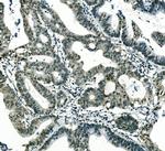 MSI1 Antibody in Immunohistochemistry (Paraffin) (IHC (P))