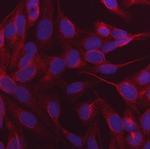 CALCOCO2 Monoclonal Antibody (9E2F2)