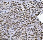 ERLIN2 Antibody in Immunohistochemistry (Paraffin) (IHC (P))