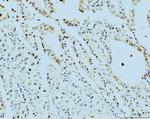 PSMC3 Antibody in Immunohistochemistry (Paraffin) (IHC (P))
