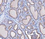 KLHL12 Monoclonal Antibody (2G11D1)