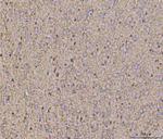 Calcineurin B Monoclonal Antibody (CN-A1)