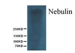 Nebulin Monoclonal Antibody (NB2)