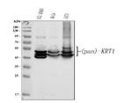 Cytokeratin 1 Antibody in Western Blot (WB)