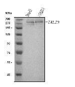Talin 2 Monoclonal Antibody (8d4)