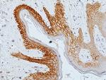 EGFR Antibody in Immunohistochemistry (Paraffin) (IHC (P))