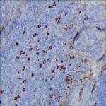 Human IgG3 Monoclonal Antibody (1A5)