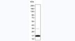 IL-2 Monoclonal Antibody (KT220)