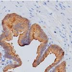 PSA Monoclonal Antibody (KT166)