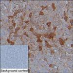 alpha-1 Microglobulin Monoclonal Antibody (KT157)
