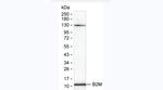 beta-2 Microglobulin Monoclonal Antibody (KT134)