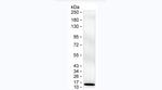 S100B Monoclonal Antibody (KT170)