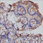 CD66e (CEA) Antibody in Immunohistochemistry (Paraffin) (IHC (P))
