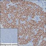 GATA3 Antibody in Immunohistochemistry (Paraffin) (IHC (P))