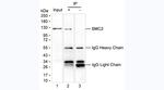 Acetyl-SMC2 (Lys114) Monoclonal Antibody (KT184)