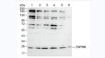 CMTM6 Monoclonal Antibody (RCT11)