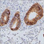 CMTM6 Monoclonal Antibody (RCT2)