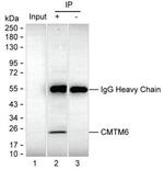 CMTM6 Antibody in Immunoprecipitation (IP)