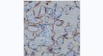 hCG beta Monoclonal Antibody (KT152)