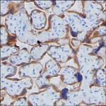hCG beta Antibody in Immunohistochemistry (Paraffin) (IHC (P))