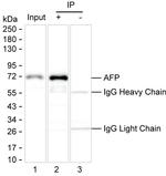 AFP Monoclonal Antibody (KT137)