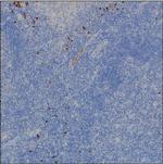 Human IgG2 Antibody in Immunohistochemistry (Paraffin) (IHC (P))