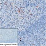 Human IgG Monoclonal Antibody (KT131)