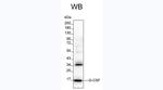 G-CSF Monoclonal Antibody (KT26)