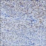 FGF2 Monoclonal Antibody (KT49)