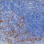 Human IgG Monoclonal Antibody (KT47)