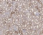KEAP1 Recombinant Rabbit Monoclonal Antibody (PSH0-90)