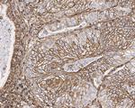 AHNAK Antibody in Immunohistochemistry (Paraffin) (IHC (P))