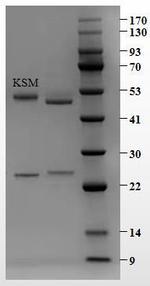 Kitasamycin Antibody in SDS-PAGE (SDS-PAGE)