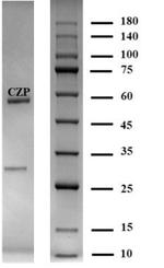 Clonazepam Monoclonal Antibody (5C10)