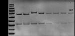Clobetasol Propionate Monoclonal Antibody (1B7)