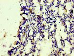 CD163 Antibody in Immunohistochemistry (Paraffin) (IHC (P))