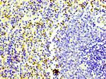 CD163 Antibody in Immunohistochemistry (Paraffin) (IHC (P))