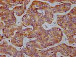 Phospho-EIF2S1 (Ser51) Antibody in Immunohistochemistry (Paraffin) (IHC (P))