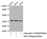 Phospho-EIF2S1 (Ser51) Antibody in Western Blot (WB)