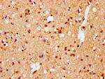 Phospho-alpha Synuclein (Ser129) Antibody in Immunohistochemistry (Paraffin) (IHC (P))
