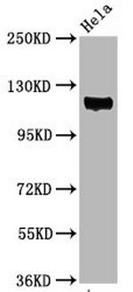 Phospho-FAK (Tyr397) Recombinant Rabbit Monoclonal Antibody (1B3)