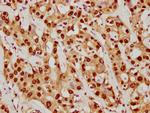 SUMO1 Antibody in Immunohistochemistry (Paraffin) (IHC (P))