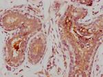 MMP9 Antibody in Immunohistochemistry (Paraffin) (IHC (P))